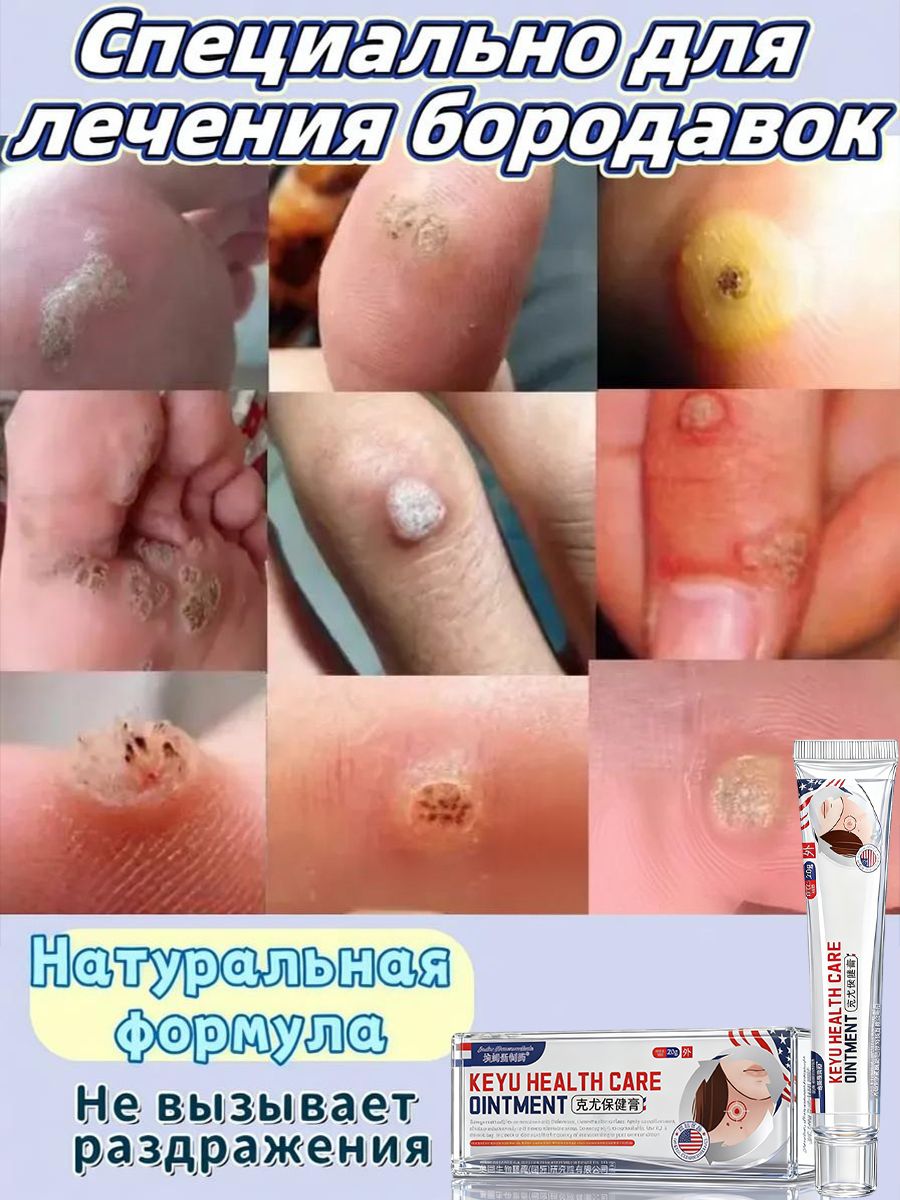 Papilloma Fit Cream 25 g