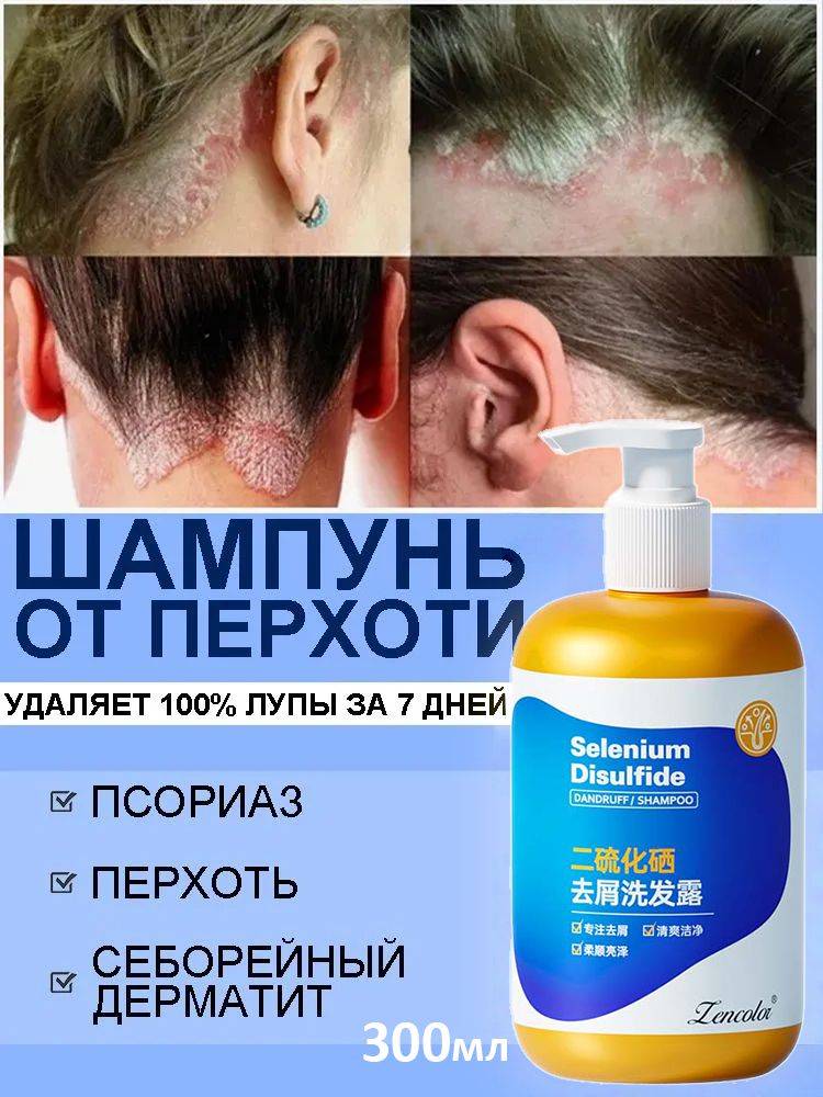 DR.SKINVITA Anti-Dandruff Shampoo 300ml Bag-in-Box (Unisex)