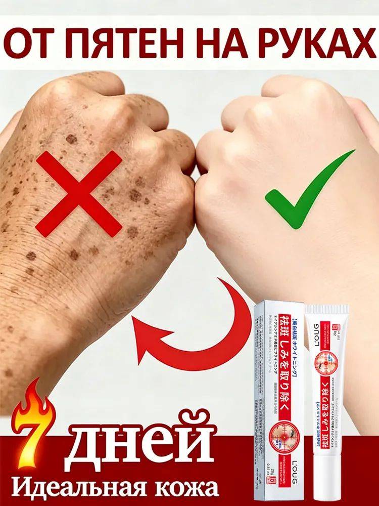DR.SKINVITA Whitening and Freckle Cream 20 g