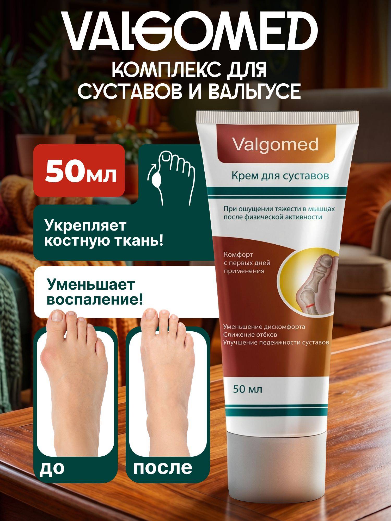 Valgomed Foot Cream for Joint Care and Valgus Support 51 ml
