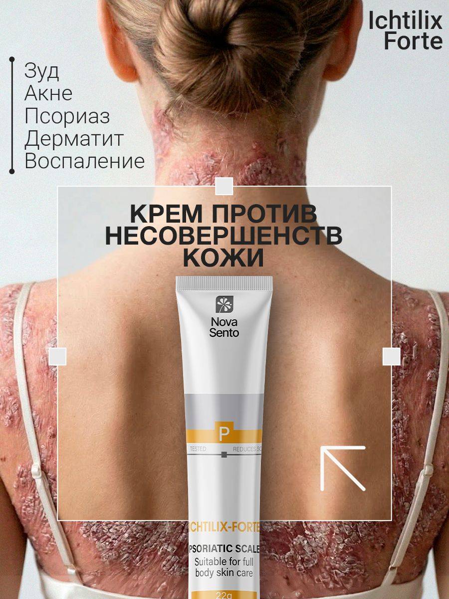 Ichtilix-Forte Skin Care Ointment for Problem Skin Cream 22 g