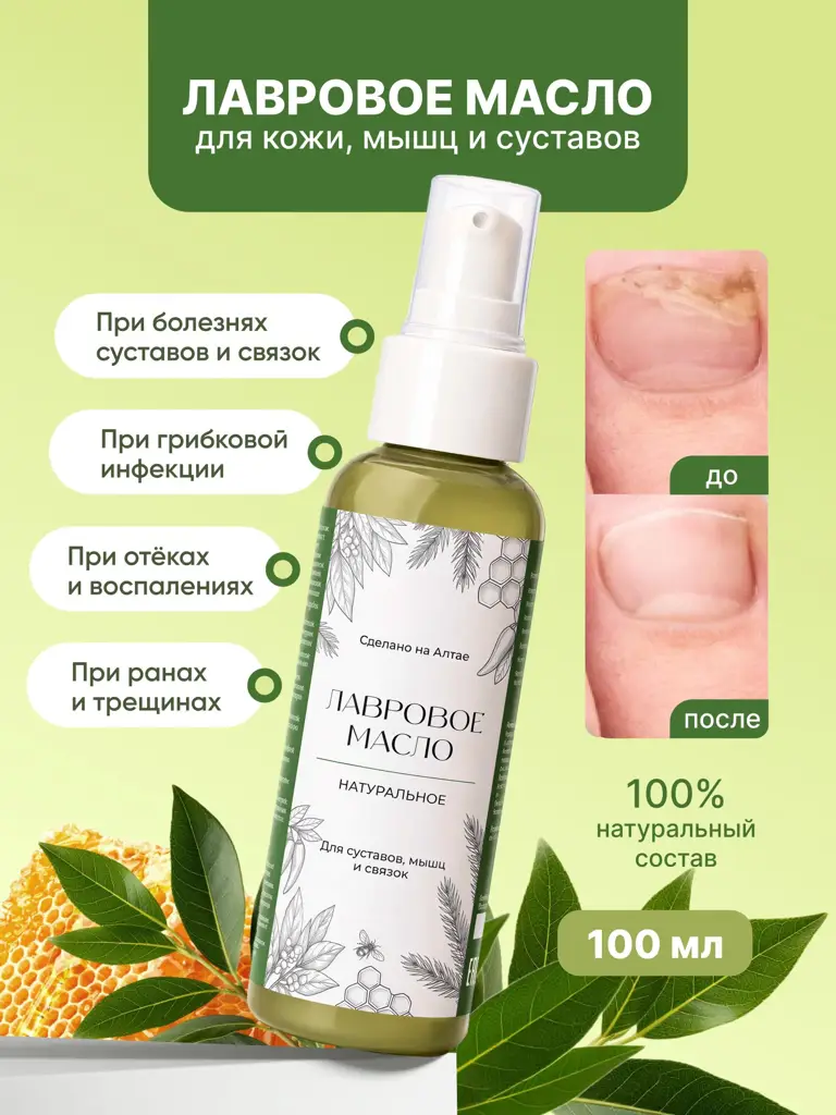 Bay Laurel Oil for Joints, Muscles & Ligaments, 100 ml #1