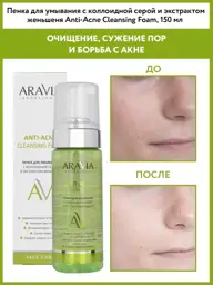 Colloidal Sulfur Facial Cleansing Foam, 150 ml #1
