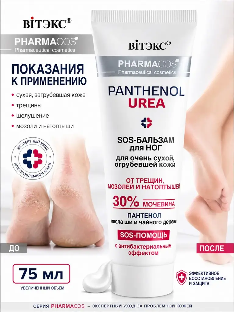 Vitex SOS Foot with 30% Urea Cream #1