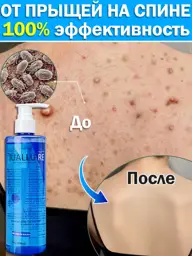IUALLURE Acne Care Shower Gel, 300 ml #1