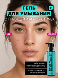 11i professional Acne Cleansing Face Wash #1
