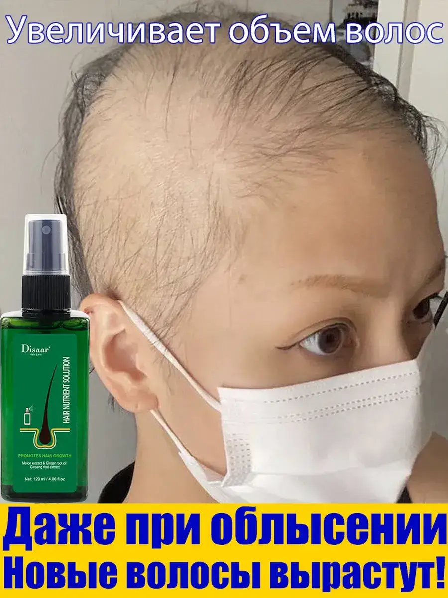 Professional Hair Growth Spray, 120 ml