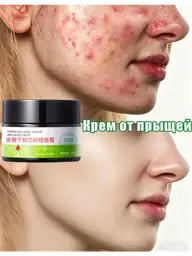 Acne Face Cream, 30 g #1