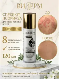VIDERM Skin Care Spray 120 ml #1