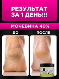 TOKISHI B Foot Cream with Urea 300 ml #1
