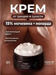 SPHENE Professional Foot Cream with 15% Urea and Monarda, 150 ml #1