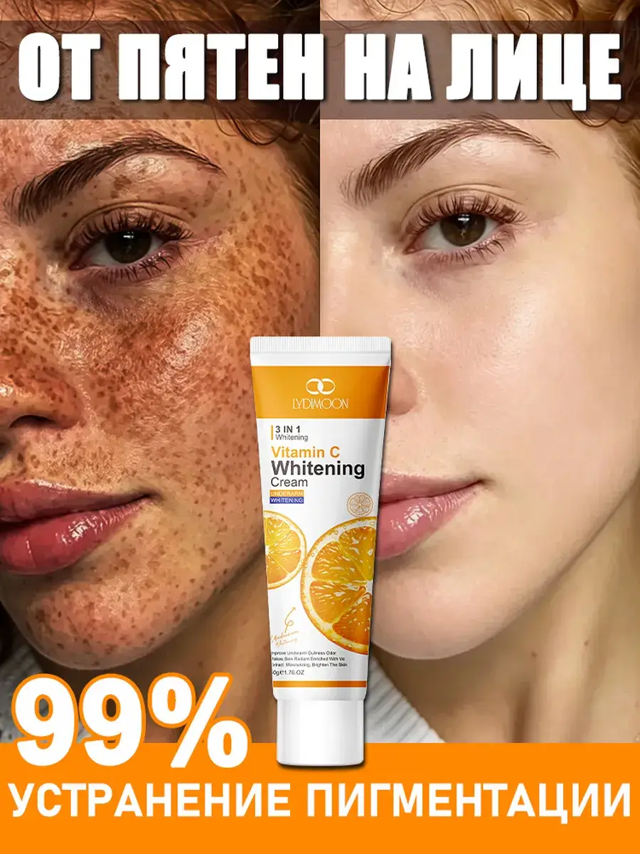 LYDIMOON Facial Whitening Cream for Pigmentation 50 ml
