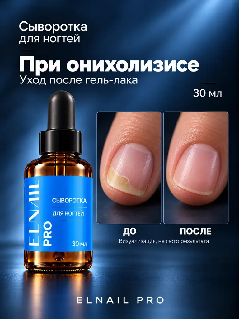 ELNAIL PRO Stop Onycholysis Regenerating Nail Serum, 30 ml #1