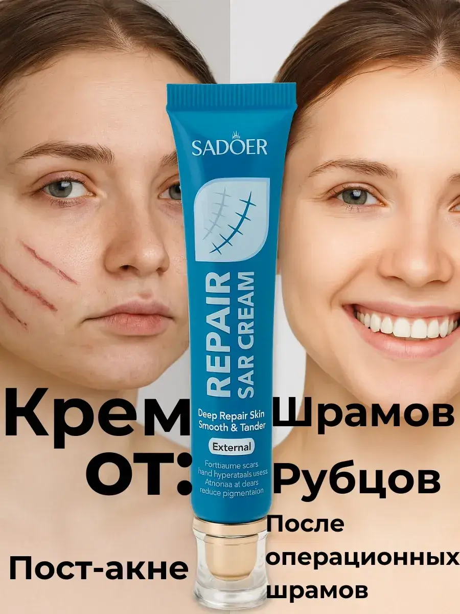 Aina.7 Scar and Blemish Cream, 20 g