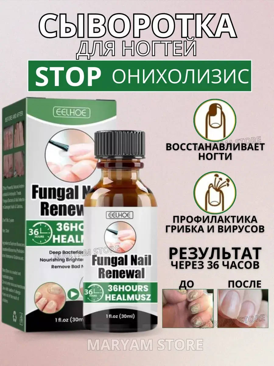 FOHUS STORE Foot Nail Care Cream 30 g