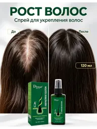 Hair Growth Anti-Hair Loss Spray, 120 ml #1