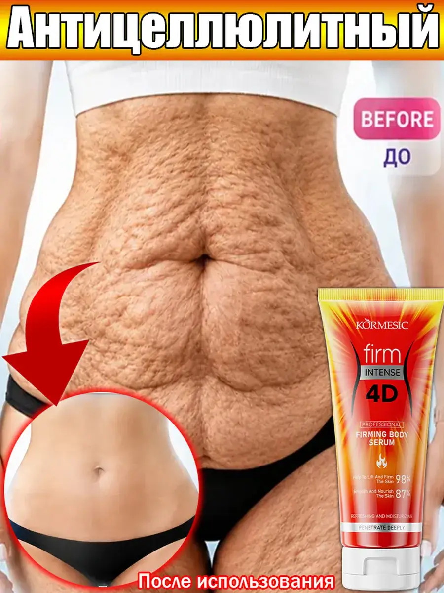 KORMESIC 4D Body Firming Cream