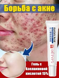 Azelaic Acid Acne Cream 20 g #1