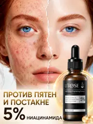 U’ROSE Brightening Facial Serum with Niacinamide 30 ml #1