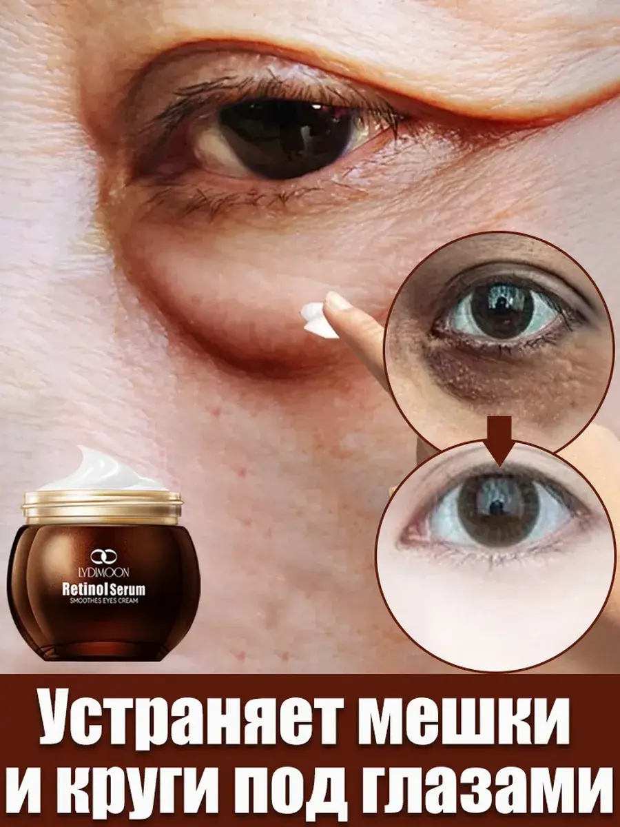 Retinol Eye Cream, 35 g