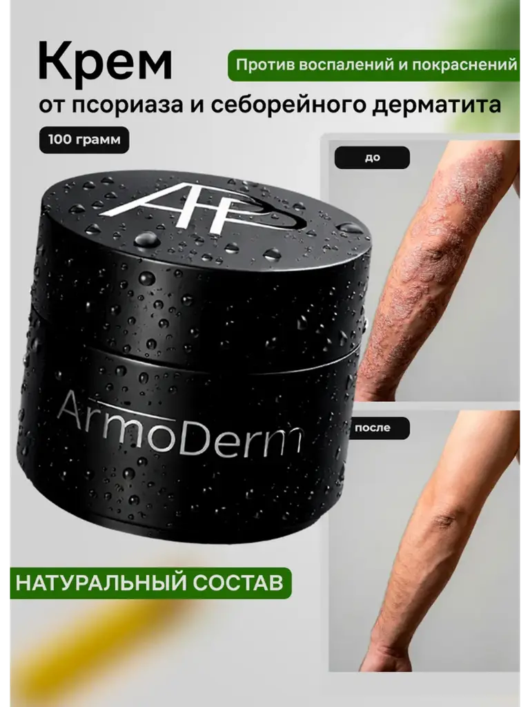ArmoDerm Emulsion for Psoriasis and Seborrheic Dermatitis Cream #1