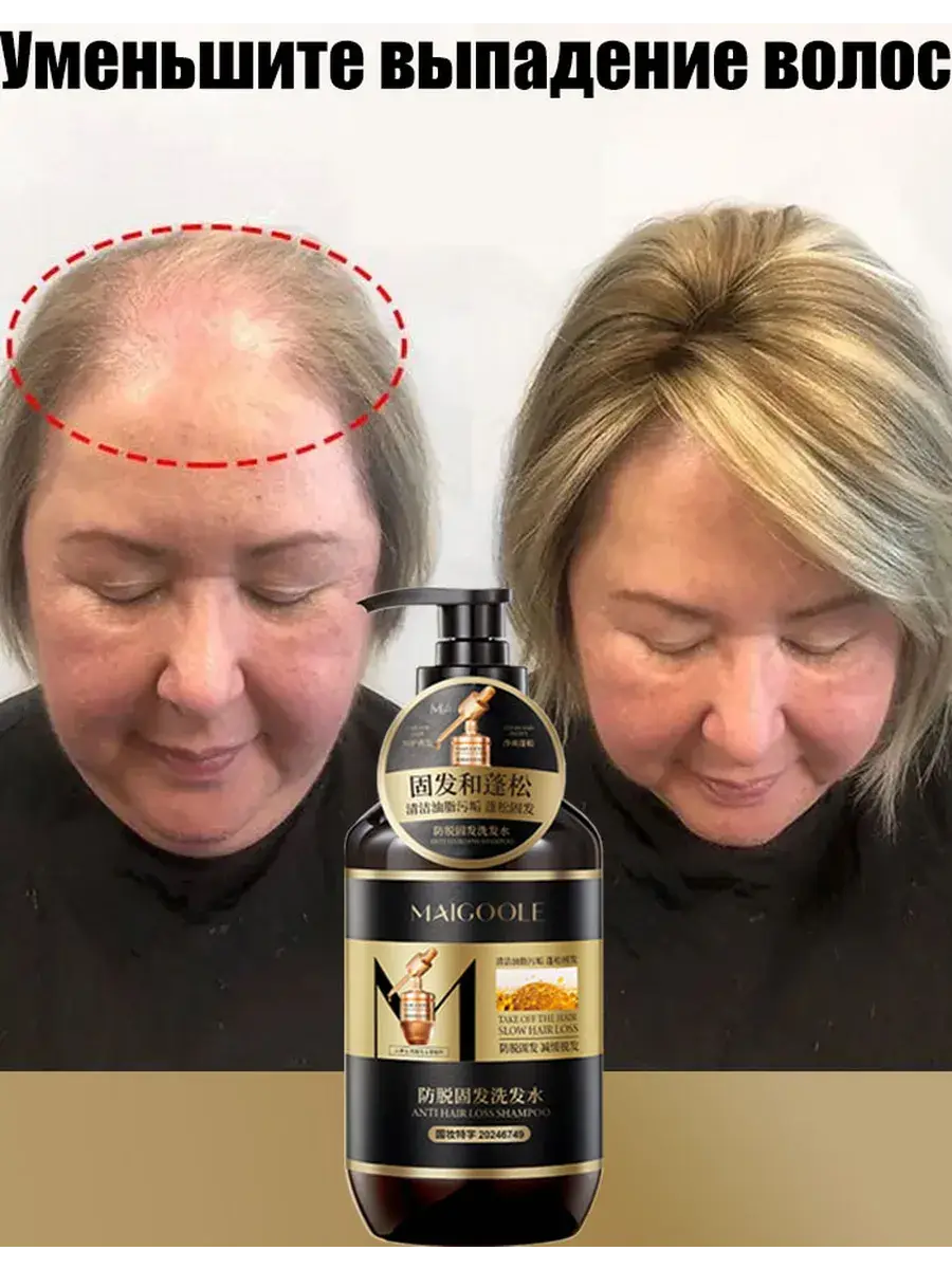 Meidailing Hair Loss Prevention Shampoo 400 ml