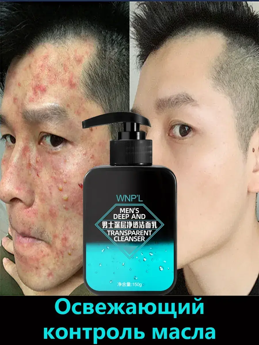 Men's Anti-Acne Facial Cleansing Foam 150 ml