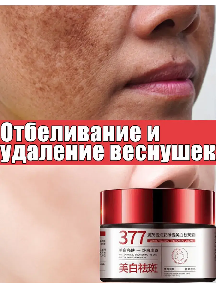 Face Cream for Pigmentation and Freckle Lightening, SPF 25, 30 ml