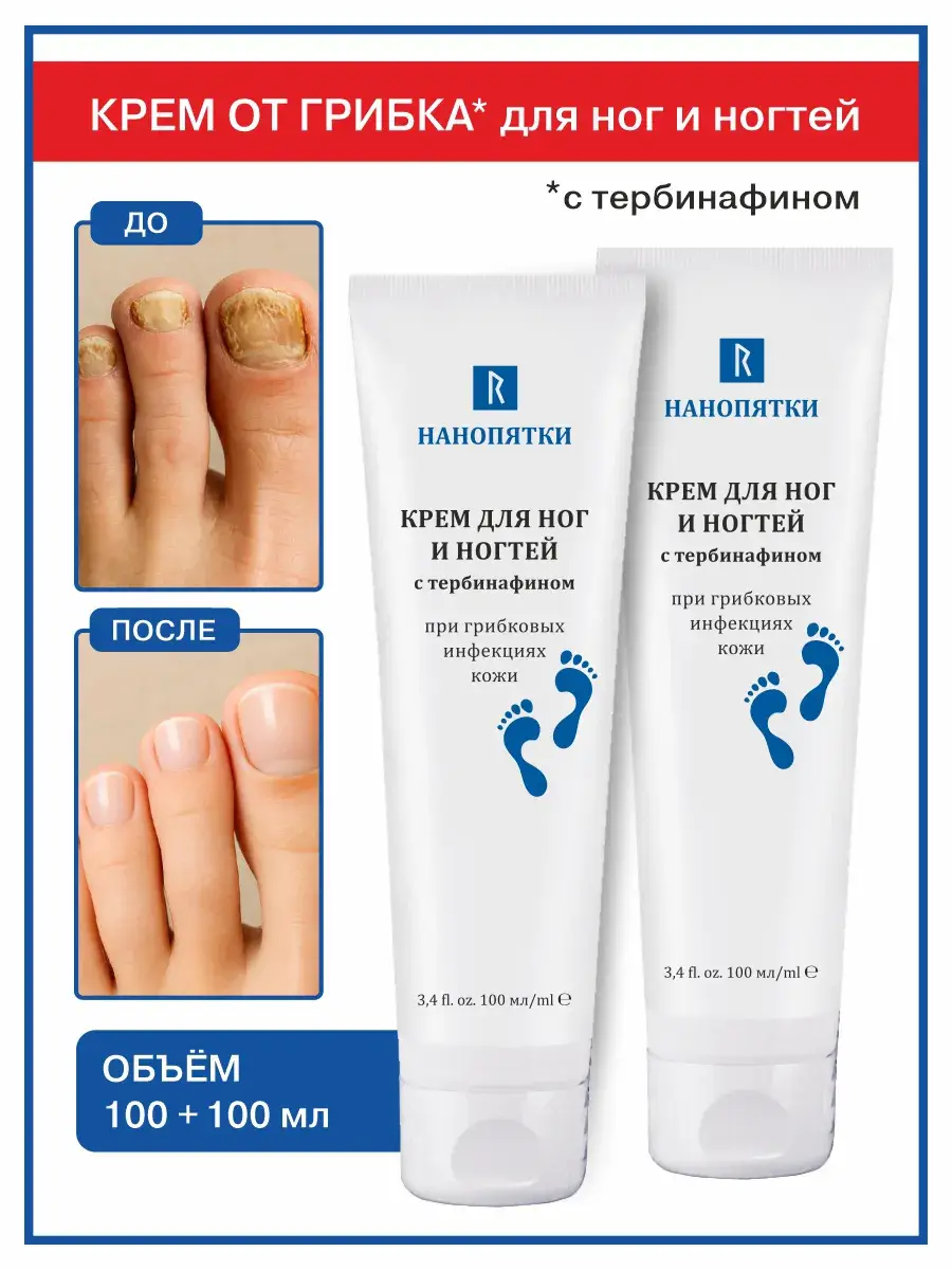 Nanopyatki Antifungal Nail and Foot Cream 2 Pack