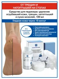 Nanopyatki Heel Care Kit with Keratolytic, Pumice and Accessories #1