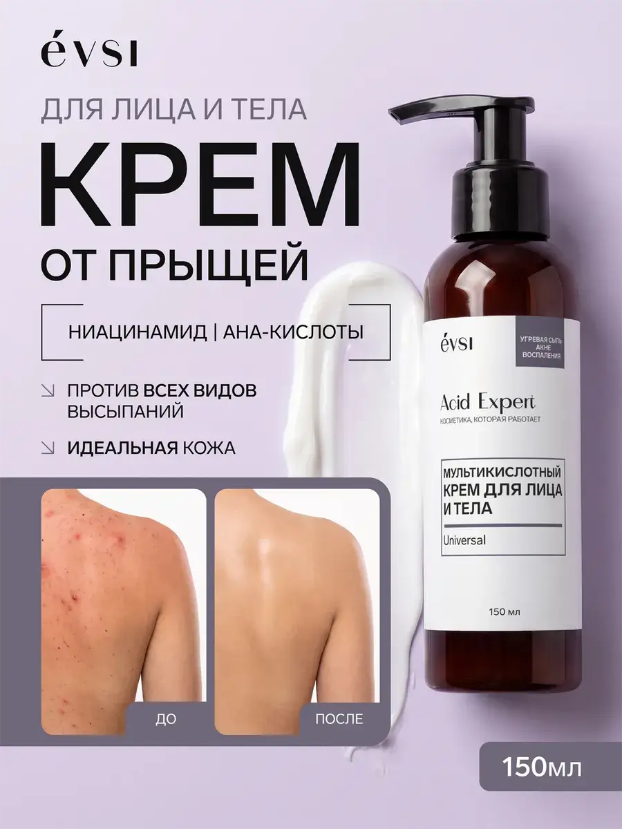 EVSI Multi-Acid Face and Body Acne Cream 150 ml