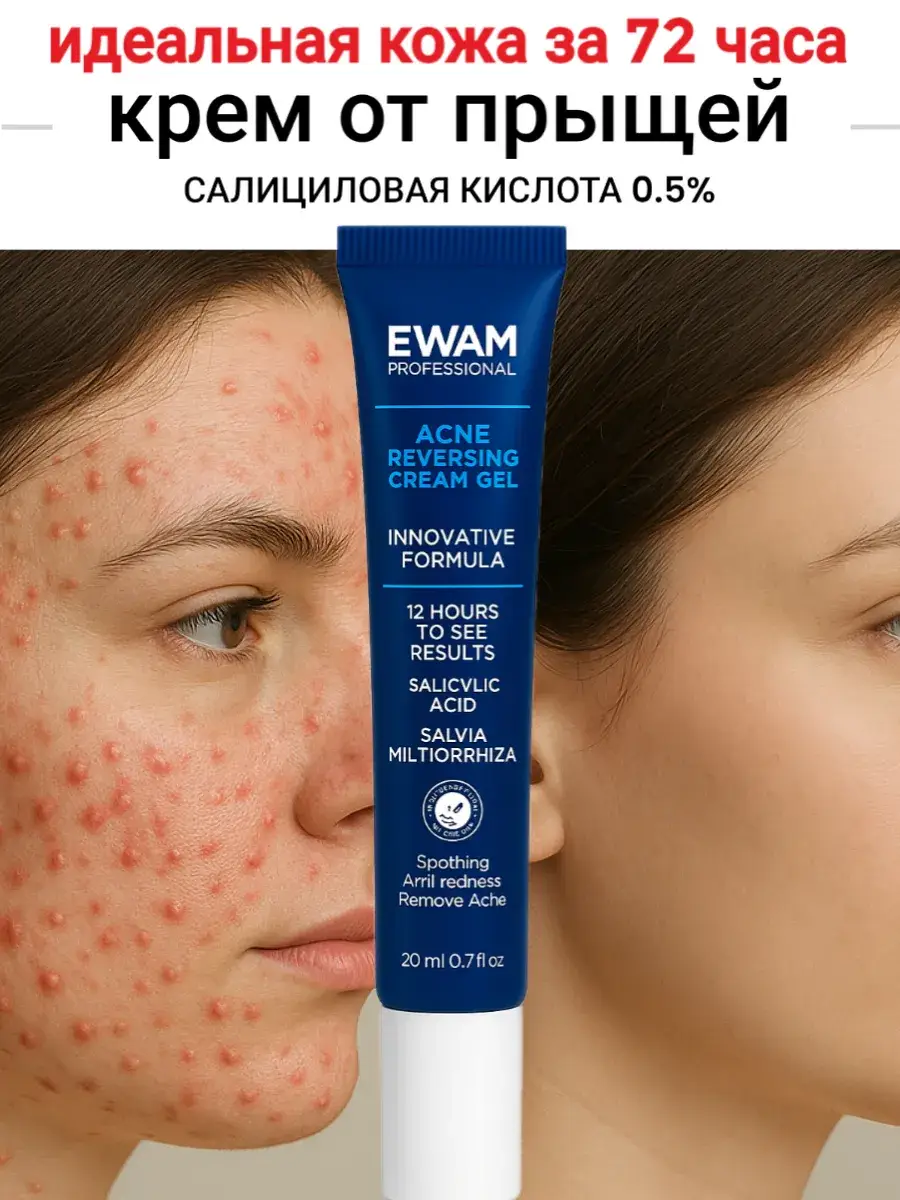 EWAM Salicylic Acid 0.5% Face Cream, 20 ml