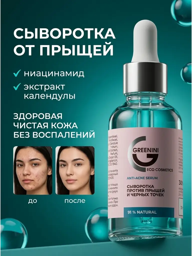 Greenini Serum for Blemishes and Blackheads, 30 ml #1