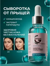 Greenini Serum for Blemishes and Blackheads, 30 ml #1
