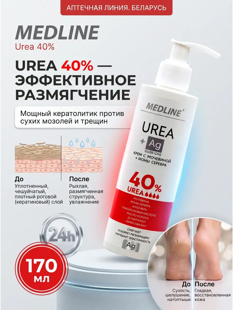 MedLine+ 40% Urea Foot Cream, 170 ml