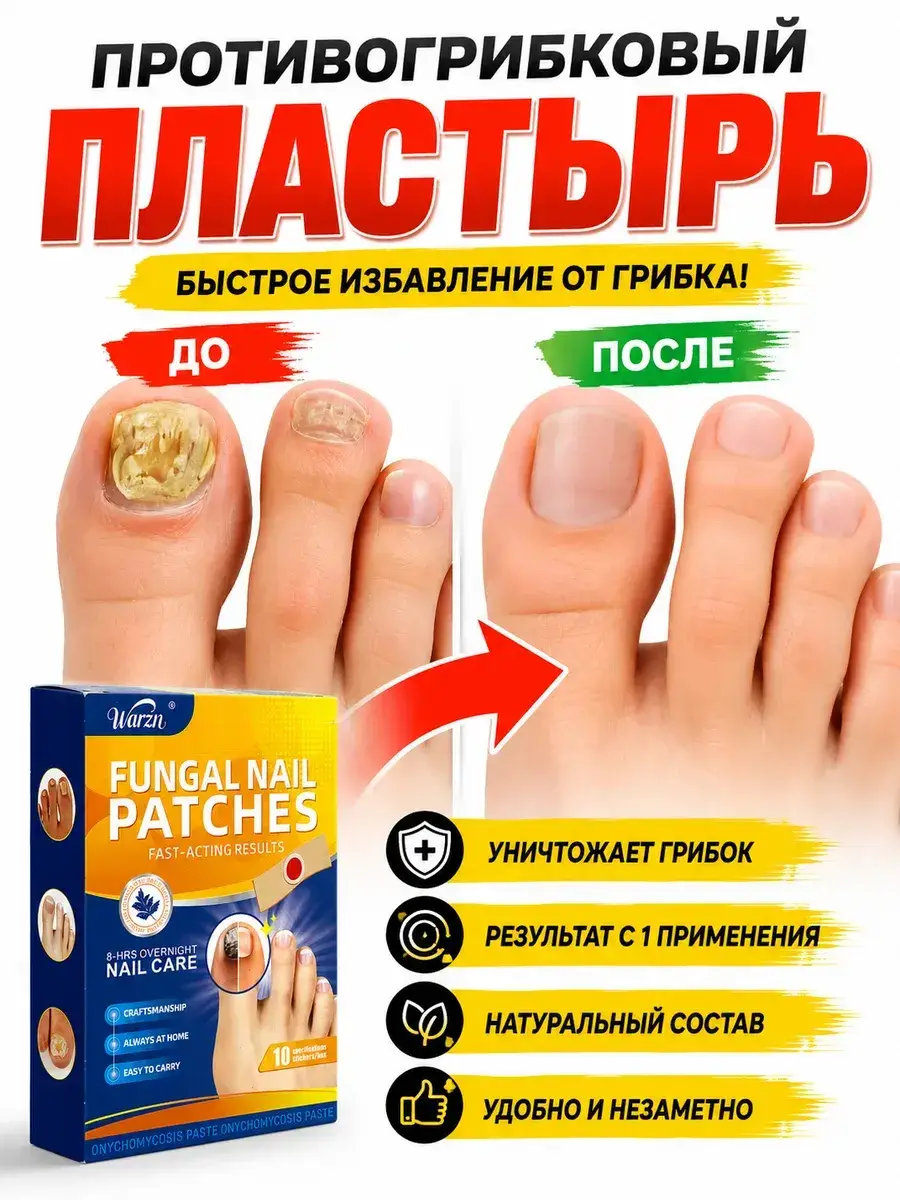 Almugni Antifungal Nail Patch 10 Pack