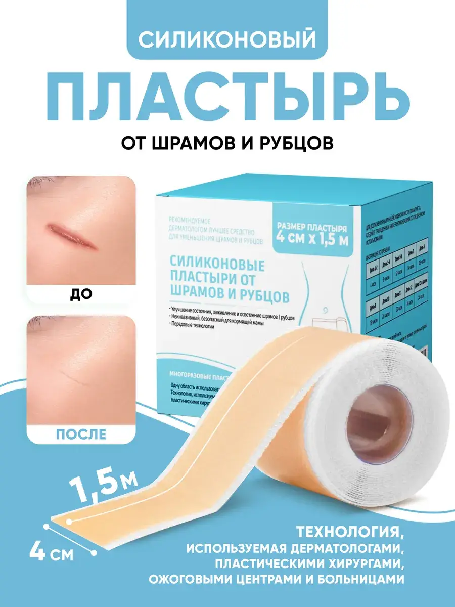 ELVISH Silicone Scar Sheet 4 cm x 150 cm, 1 Roll Patches