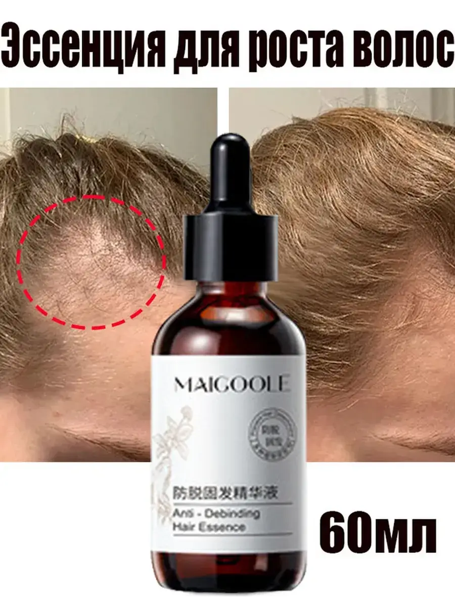 Hair Growth Essence, 60 ml