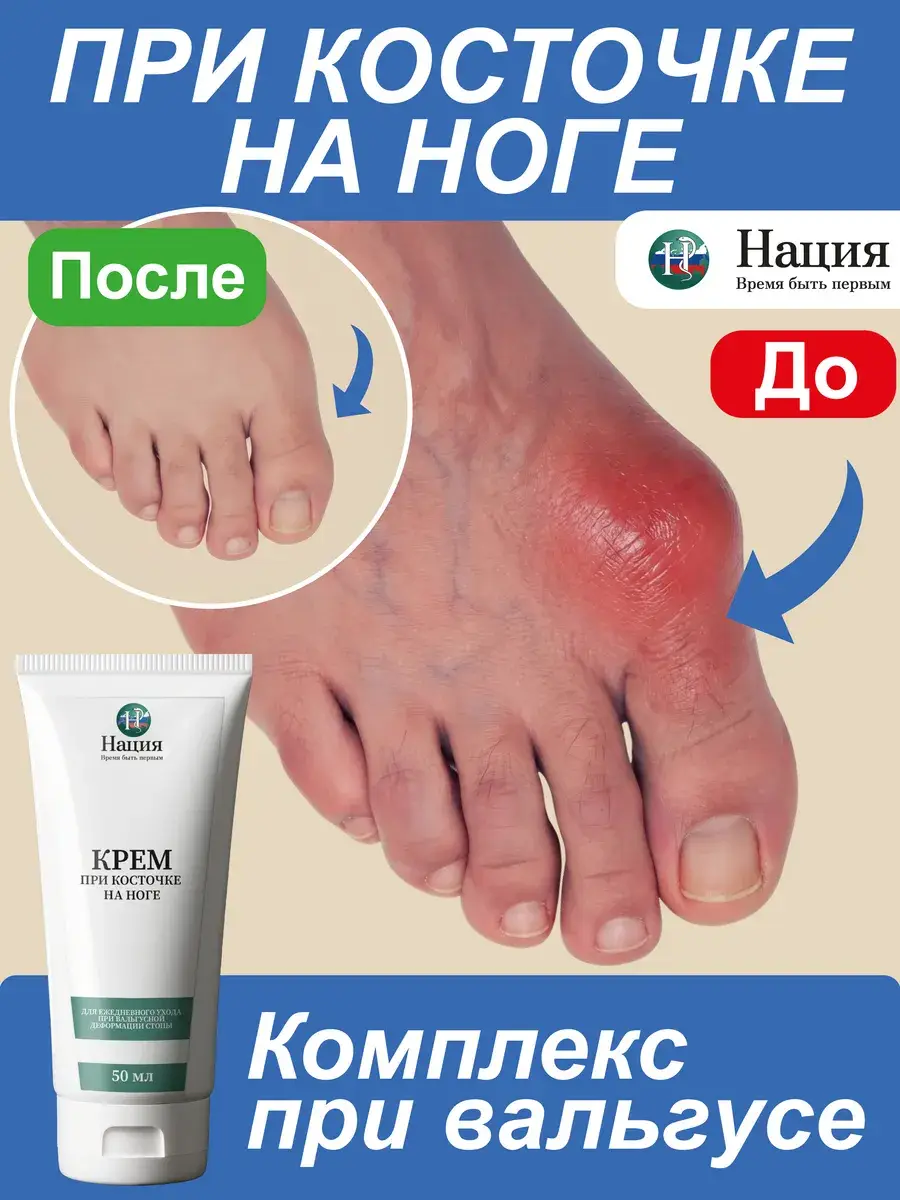 Nacia Bunion Care Cream 50 ml