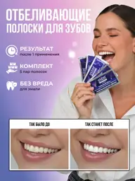 Crest 3D White Whitestrips Teeth Whitening Strips, 5 Packets #1