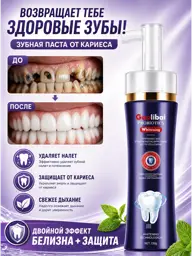 Whitening Toothpaste with Probiotics, Fresh Mint, 150 g #1