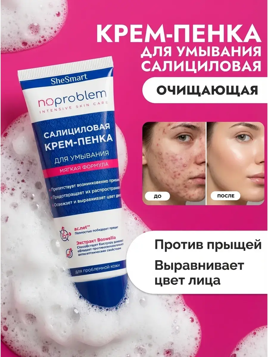 Anti Acne Salicylic Cream Facial Cleansing Foam 100 ml
