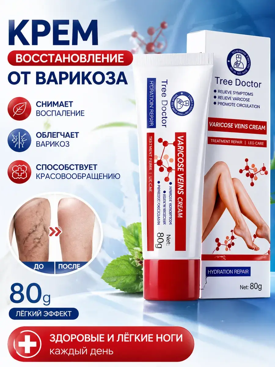 Varicose Vein Leg Cream 80 ml