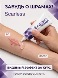 Scarless Scar and Scar Gel, 50 ml #1
