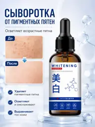 Face Serum for Pigmentation, 90 ml #1