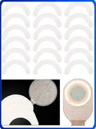 Ostomy Skin Barrier Strips, Hydrocolloid Half-Rings, 20 Pieces #1