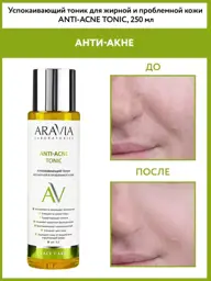 Soothing Toner for Oily and Problem Skin, 250 ml #1