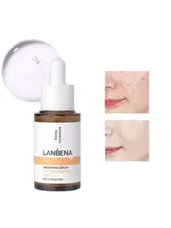 LANBENA Niacinamide Serum, 30 ml #1