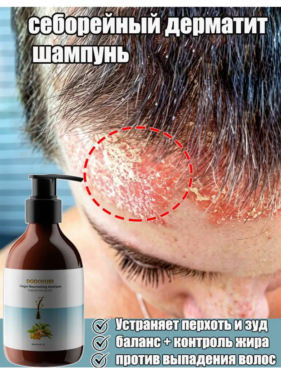 DODOYURI Anti-Dandruff Selenium Disulfide Shampoo 300 ml