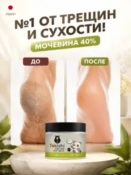 TOKISHI V Foot Cream Gel with 40% Urea, 300 ml #1